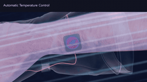 CG illustration of heating that extends to the fingertips